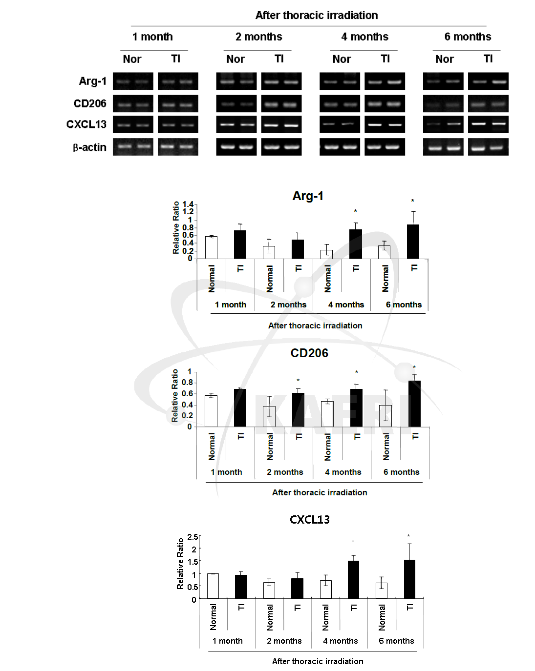 흉부 방사선 조사 후 기간별 폐 조직내로 유입된 대식세포의 M 2 marker(A rg-1, CD206, CX CL13)의 mRNA 발현 비교. n=5∼6마리