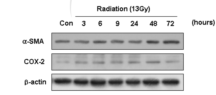 방사선 조사 후 섬유아세포(NIH-3T3)의 근섬유아세포로의 분화관련 지표의 발현 확인