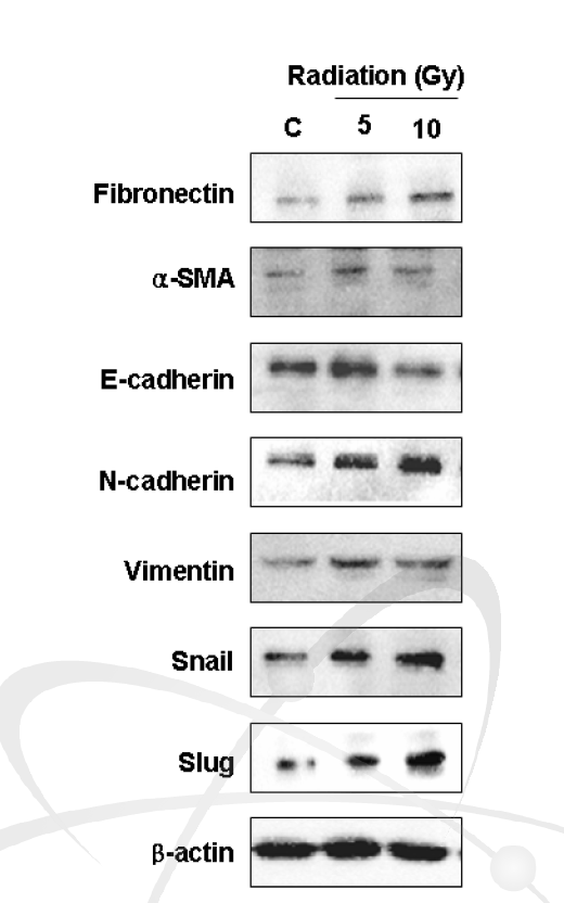 방사선 조사 후 폐 상피세포(MLE12)에서 EMT를 통한 이상분화 관련 지표의 발현 확인
