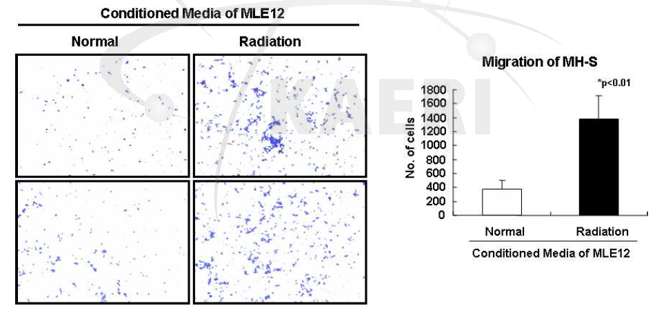 방사선 조사 된 폐 상피세포(MLE12)의 conditioned media에 의한 폐 대식세포(M H-S)의 이동성 증가 확인.