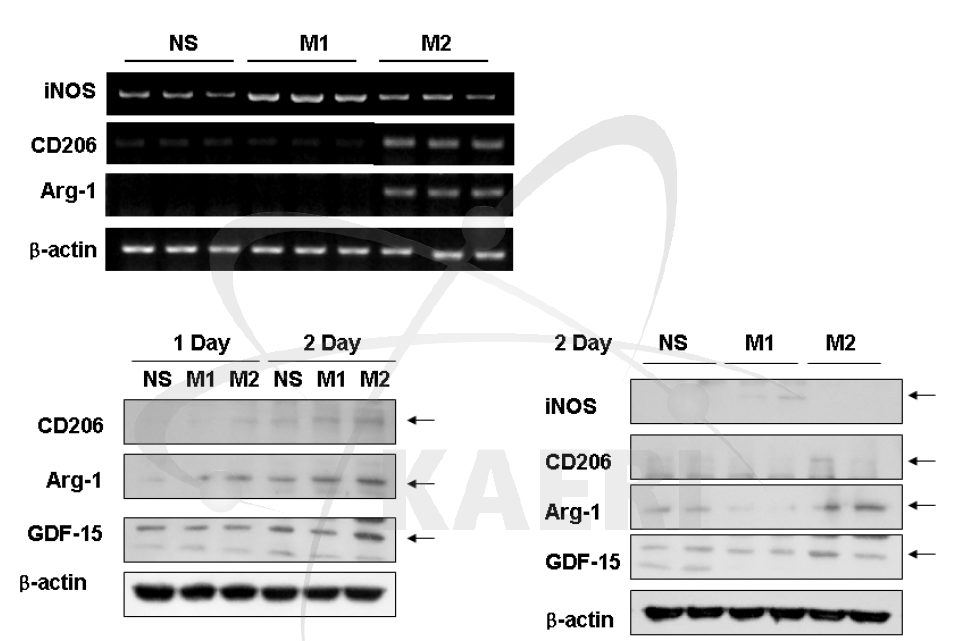 폐 대식세포(MH-S)의 M1 또는 M2 macrophage로의 분화 검증.