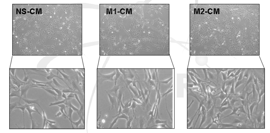 M1 또는 M2 macrophage의 conditioned media에 의한 섬유아세포(NIH-3T3)의 세포모양 변화.