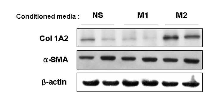 M1 또는 M2 macrophage의 conditioned media에 의한 섬유아세포(NIH-3T3)의 근섬유아세포로의 분화 관련 지표의 발현 확인.