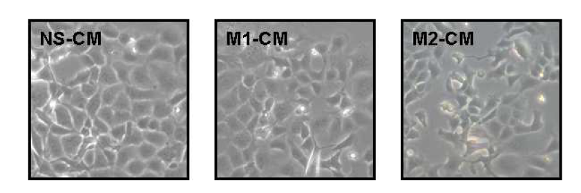 M1 또는 M2 macrophage의 conditioned media에 의한 폐 상피세포(M LE12)의 세포모양 변화.