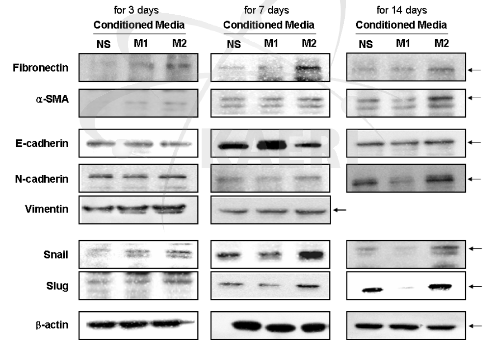 M1 또는 M2 macrophage의 conditioned media에 의한 폐 상피세포(M LE12)의 EM T를 통한 이상분화 관련 지표 발현 확인.