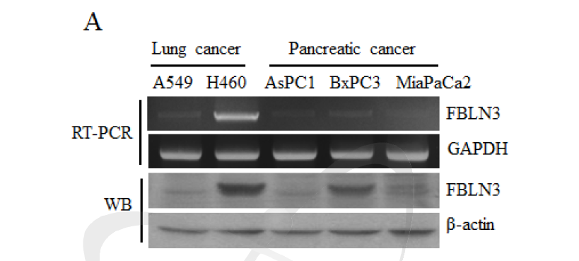 RT-PCR and Western blot of fibulin-series in A549, H460 and Aspc-1, BxPC-3와 MiaPaCa-2 cells