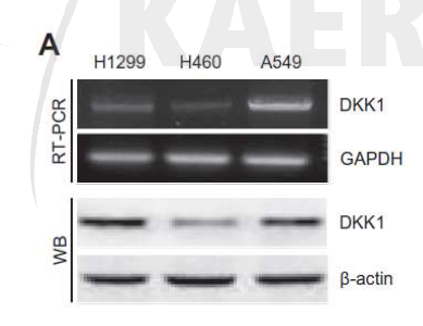 Western blot analysis and RT-PCR of DKK1 in H1299, H460 and A549 cell