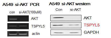 TSPY L5 expression of AKT suppression in A549 cell