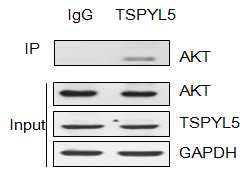 TSPYL5 and AKT interaction in A549 cell