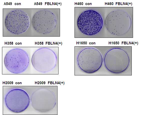 FBLN-4유전자가 과발현 된 비소세포성 폐암세포주의 콜로니 형성 분석