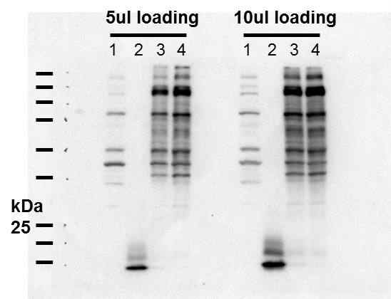 흰 쥐 신장에서 HA-Ub-VS probe를 이용 결합된 DUBs (3, 4번) 를 HA-항체로 확 인한 Western blot 결과.