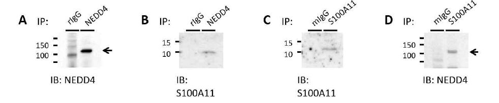 Co-IP를 통한 흰 쥐 신장 NEDD4-S100A11 결합 확인