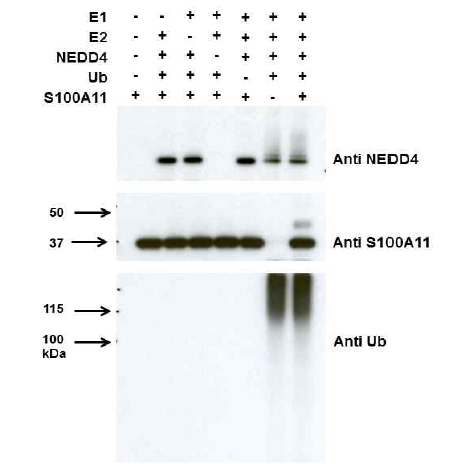 NEDD4 의존적 S100A11 유비 퀴틴화(in vitro ubiquitination)