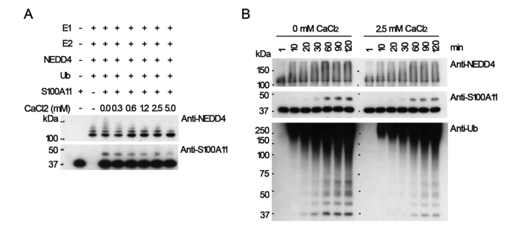 칼슘 농도 변화에 따른 NEDD4 의존적 S100A11 유비퀴틴화