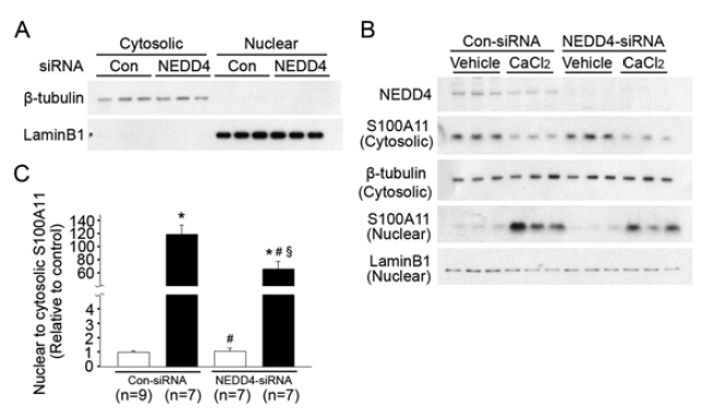 NEDD4 발현 억제에 따른 칼슘 의존적 S100A11의 핵이동 변화