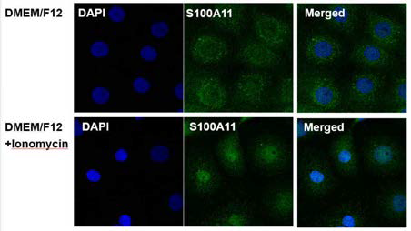 신장 IMCD에서 세포내 칼슘 농도 증가에 따른 S100A11의 핵이동 확인