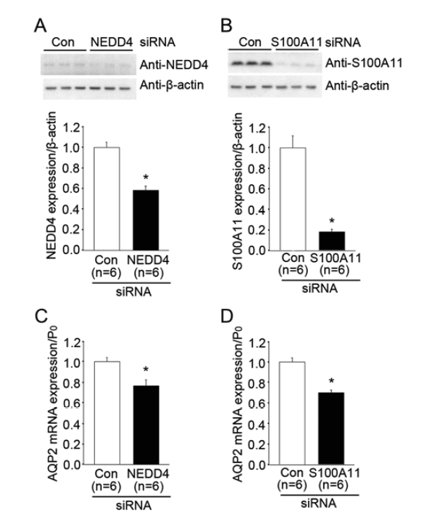 NEDD4 혹은 S100A11을 녹다운 시킨 mpkCCD 세포주에서 AQP2 mRNA 발현량 변화