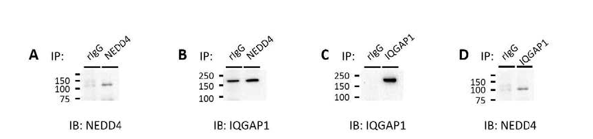 NEDD4-IQGAP1의 직접적 결합 확인