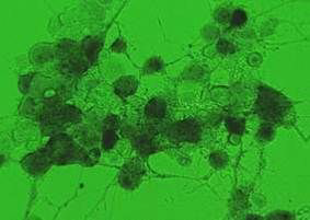 마우스 신경세포에서 증식된 야외 rabies 바이러스
