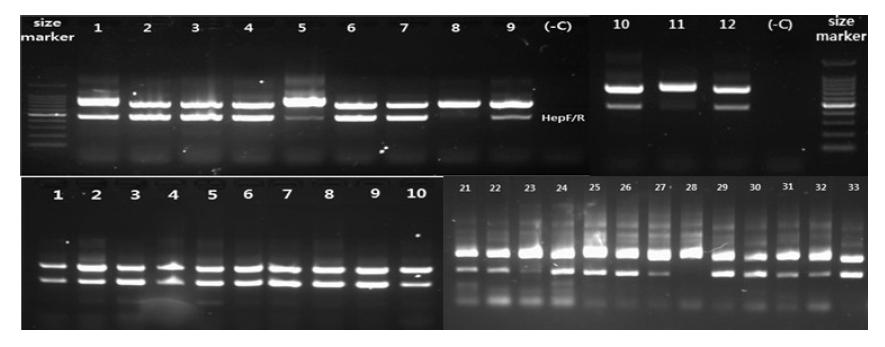 Detection of th mcyE and cyanobacterial 16S rDNA in case of occuring cyanobacteria in Yeongsan river watershed.