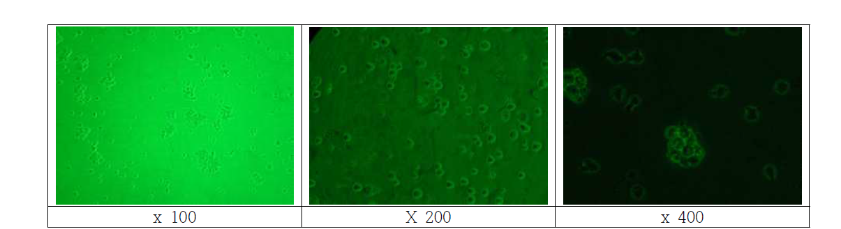 계대배양 24시간 THP-1 세포 위상차 현미경 관찰 모습