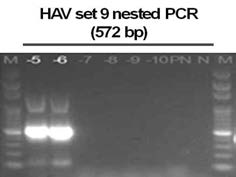 Sensitivity of 2nd PCR primer sets for the detection of HAV.