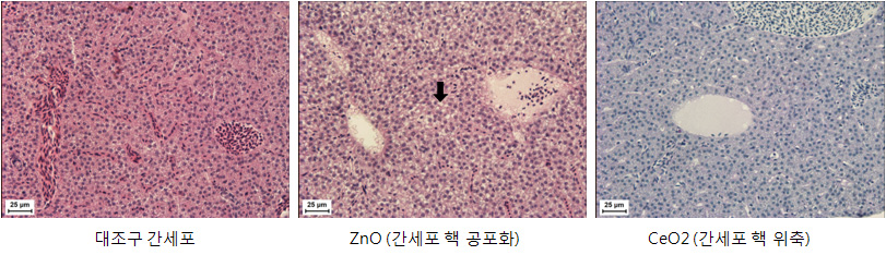 Histophathology of liver cell in zebrafish