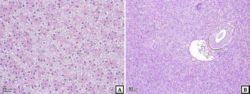 Photomicrographs of liver of crucian carp, Carassius auratus : Cheongpyeong.