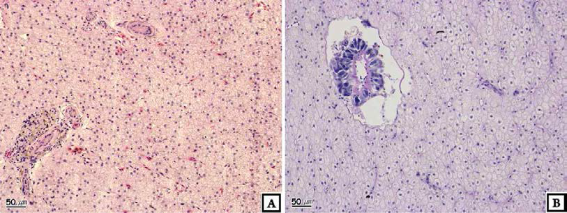 Photomicrographs of liver of crucian carp, Carassius auratus : Gwangju.