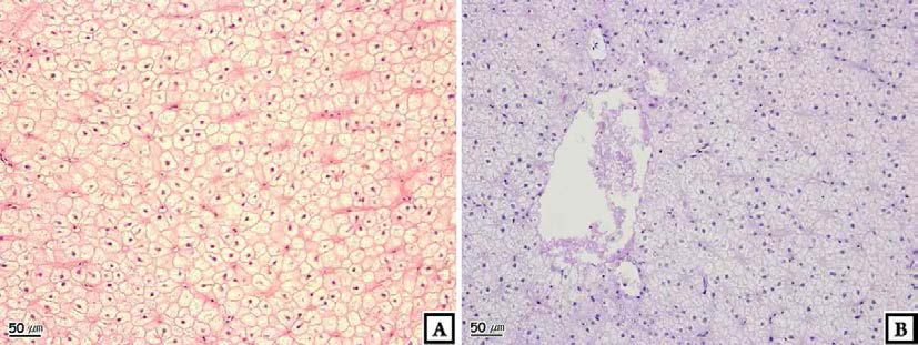 Photomicrographs of liver of crucian carp, Carassius auratus : Suncheon.