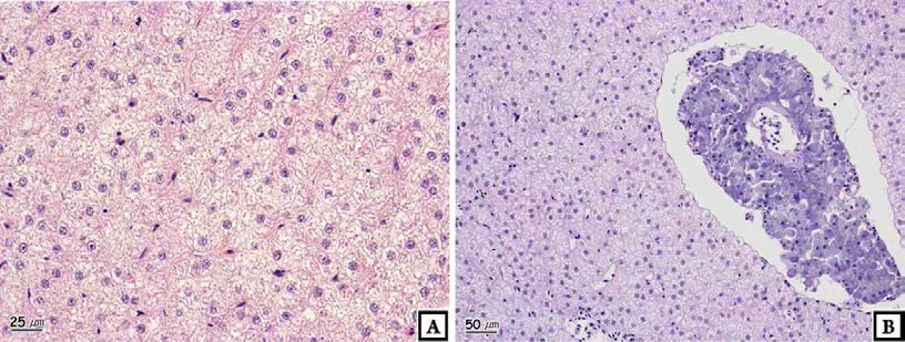 Photomicrographs of liver of crucian carp, Carassius auratus : Gumi.