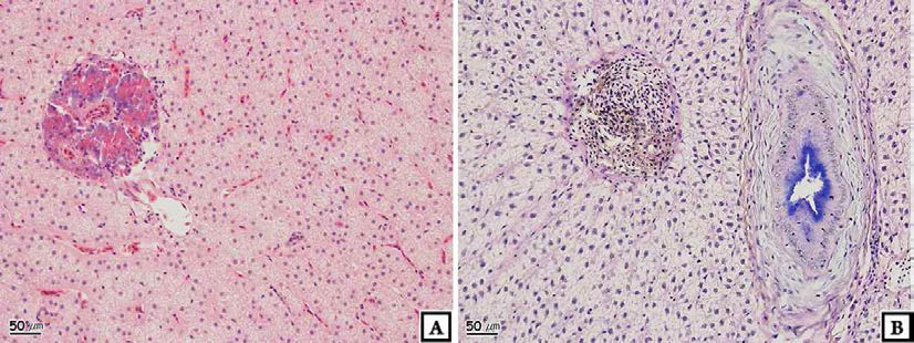 Photomicrographs of liver of crucian carp, Carassius auratus : Haman.