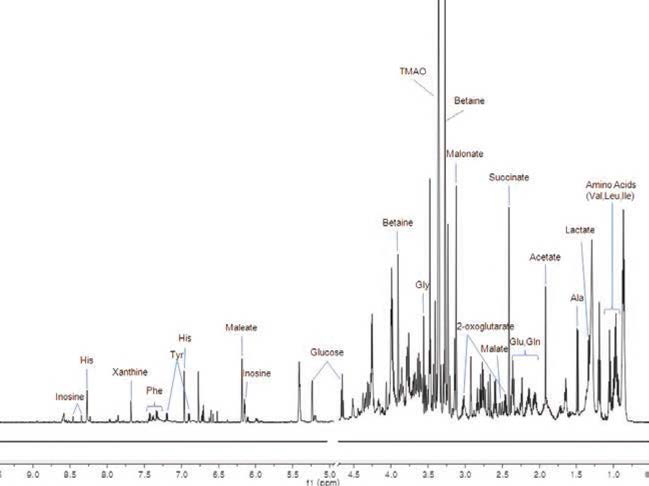 NMR spectrum of earthwarm.