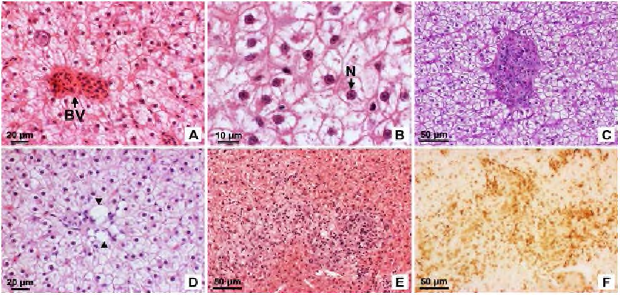 LM of liver damage of the C carpio exposed to nZnO for 12 weeks.