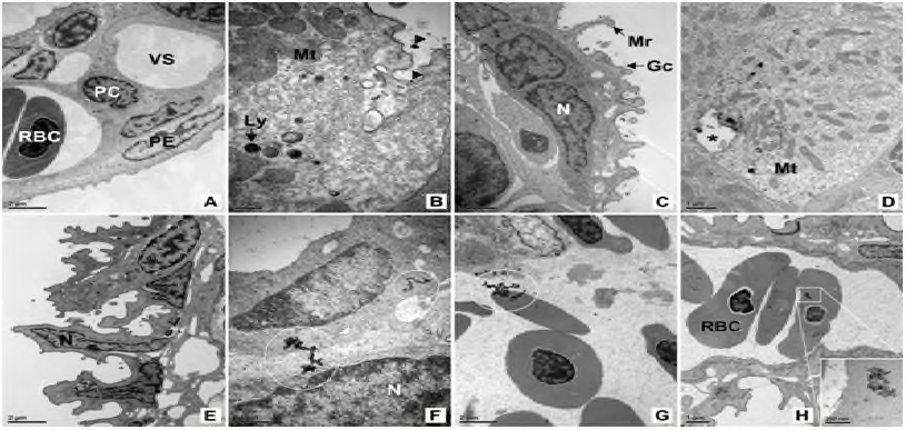 TEM of gill damage of the C carpio exposed to nZnO for 12 weeks.