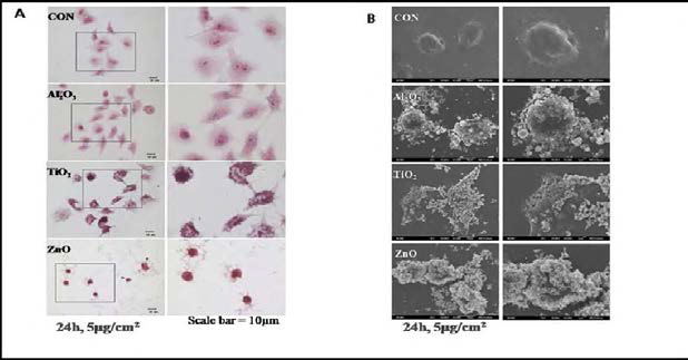 Cell morphological change. A: H&E staining. B: SEM analysis.