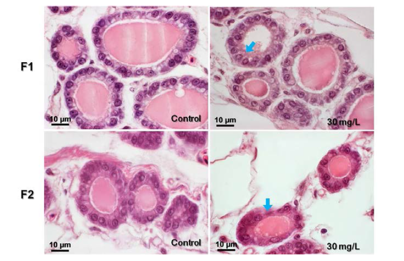 Light microscope of thyroid follicle cell of male on the medaka and pathological change in exposed to 30 mg/L PFOA