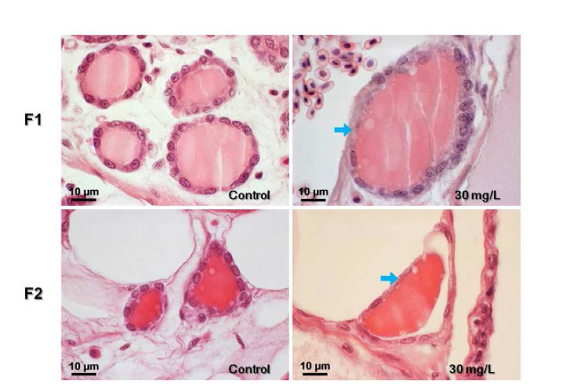 Light microscope of thyroid follicle cell of female on the medaka and pathological change in exposed to 30 mg/L PFOA