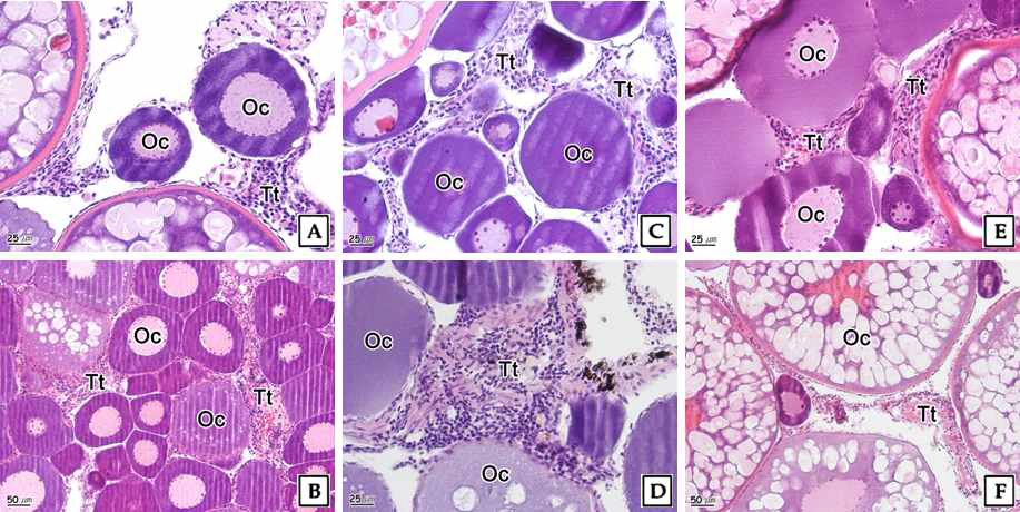 Photomicrographs of intersex gonad of crucian carp(Carassius auratus).