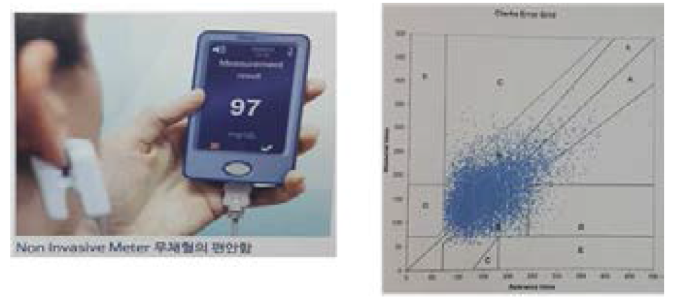 GlucoTek사 무채혈 혈당분석기