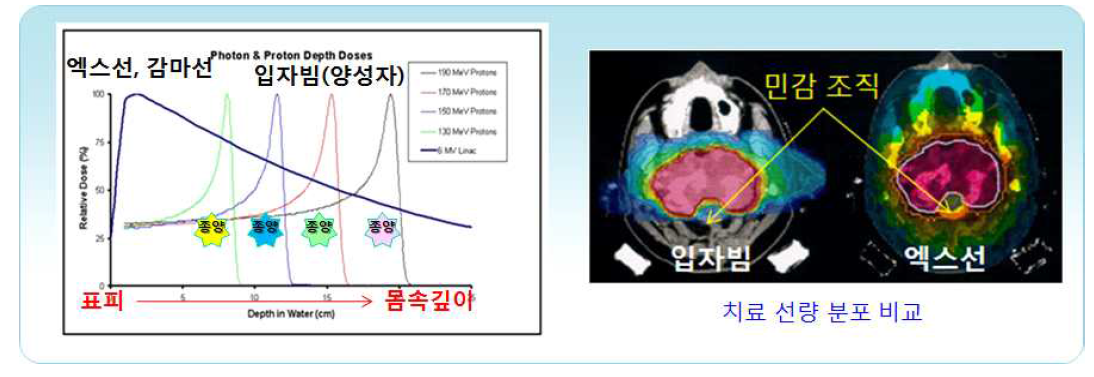 입자빔 치료의 특징