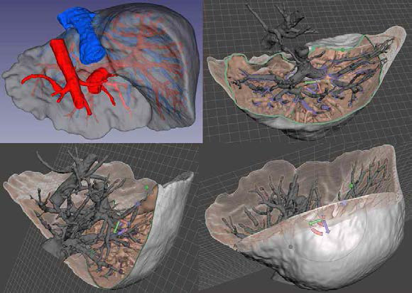 생체물성 재현을 위한 간·혈관 모델 수정과정