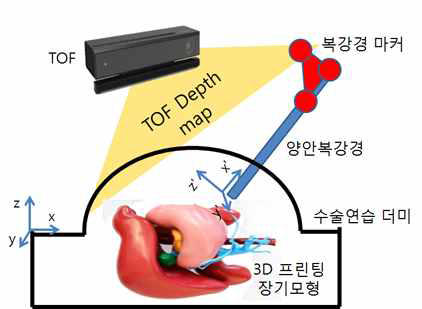 환자 마커 프리 수술도구 위치인식 개념도