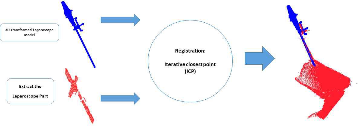 추출된 복강경 모델과 복강경 모델의 ICP 정합