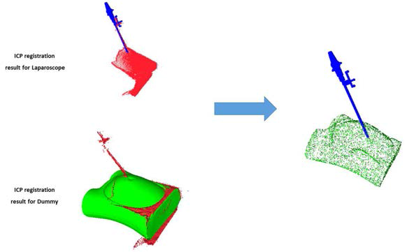 복강경 모델과 더미 모델의 최종 정합 결과