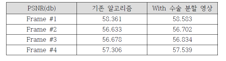 수술분할 영상 정보를 적용한 방법과의 성능 비교