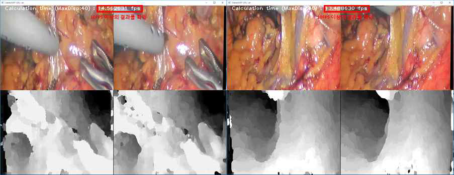 수술영상에 적용된 실시간 알고리즘의 결과 영상 및 속도