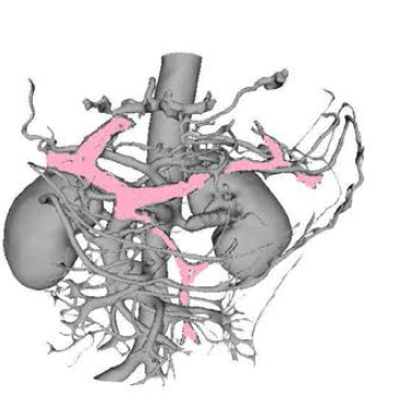 혈관 3D 해부모델과 일부분
