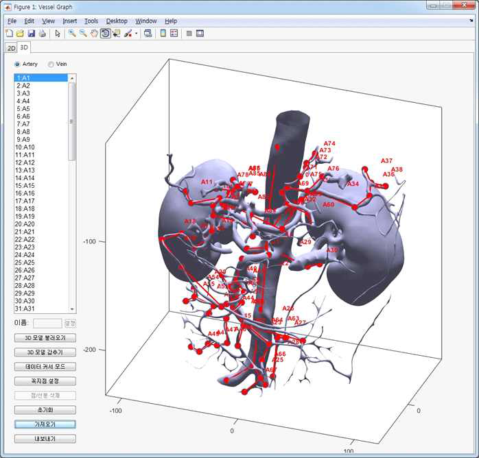 혈관 그래프모델 편집도구 3D 모드 UI