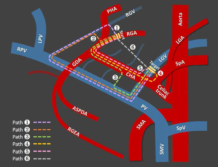 동맥 RGA에서 정맥 LGV로 이동하는 대표적인 path의 예시